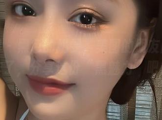 微密圈 – 黑色的奶雯，美图的朋友圈又要炸了，分享这份“黑魅力”吧！